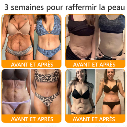 🐝🐝PUROSA® Venin d'abeille  Crème de restauration de la peau🔥 DERNIÈRE JOURNÉE – 80 % DE RABAIS !