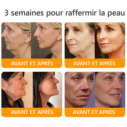 🐝🐝PUROSA® Venin d'abeille  Crème de restauration de la peau🔥 DERNIÈRE JOURNÉE – 80 % DE RABAIS !