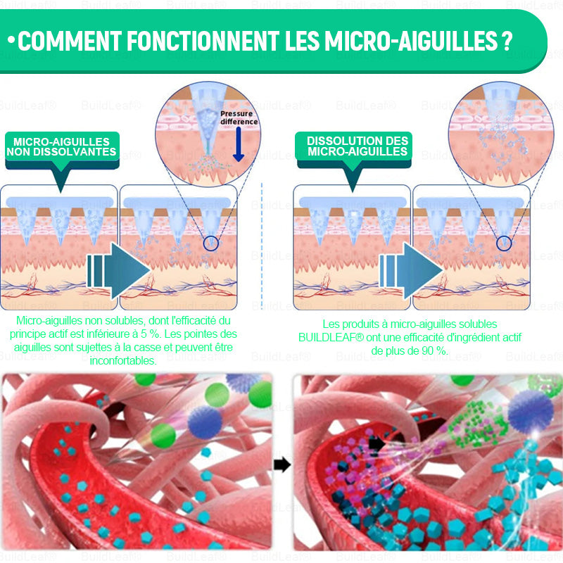 🏥Boutique officielle | Patch nano-microneedles GLP-1 BuildLeaf® avec collagène et Matrixyl 3000 – Ciblé pour l’obésité, les maladies cardiovasculaires, le diabète, l’apnée du sommeil, les problèmes articulaires et bien plus encore